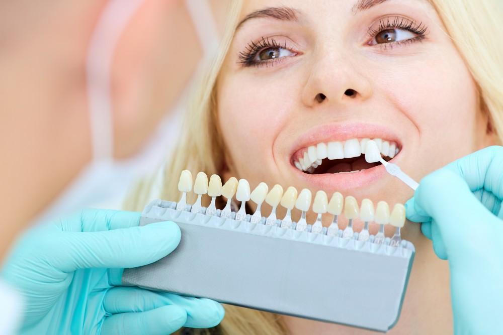 Get a Hollywood Smile Quickly With Veneers