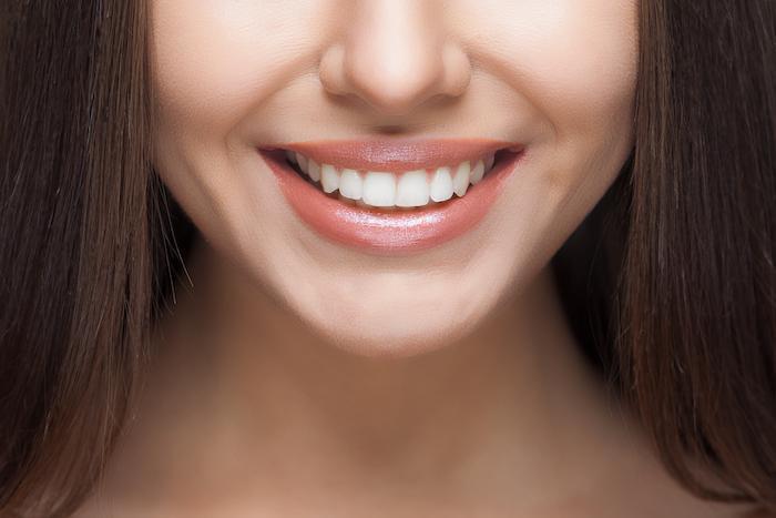 5 Benefits of Straighter Teeth