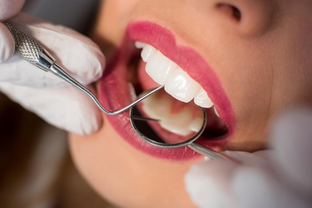 7 Invaluable Benefits of Having Regular Dental Cleanings and Exams