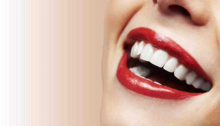 Brighten Your Smile for the Holidays With a Professional Teeth Whitening Treatment